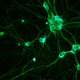Illustration for article titled Scientists may have discovered how cancer spreads around the body
